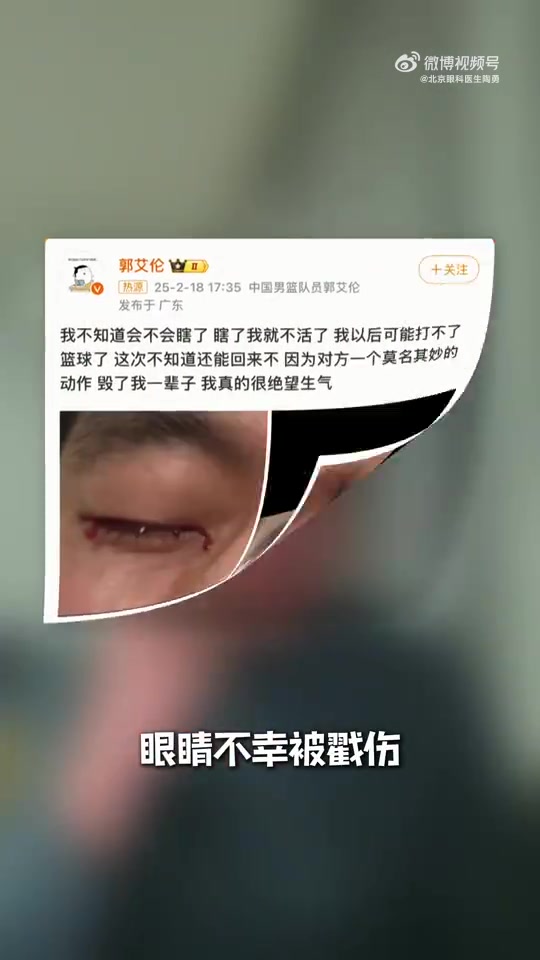 DG视讯官网平台眼科专家谈郭艾伦：结膜受伤经处理大概率恢复得不错 不要太忧心